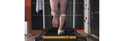 FBW